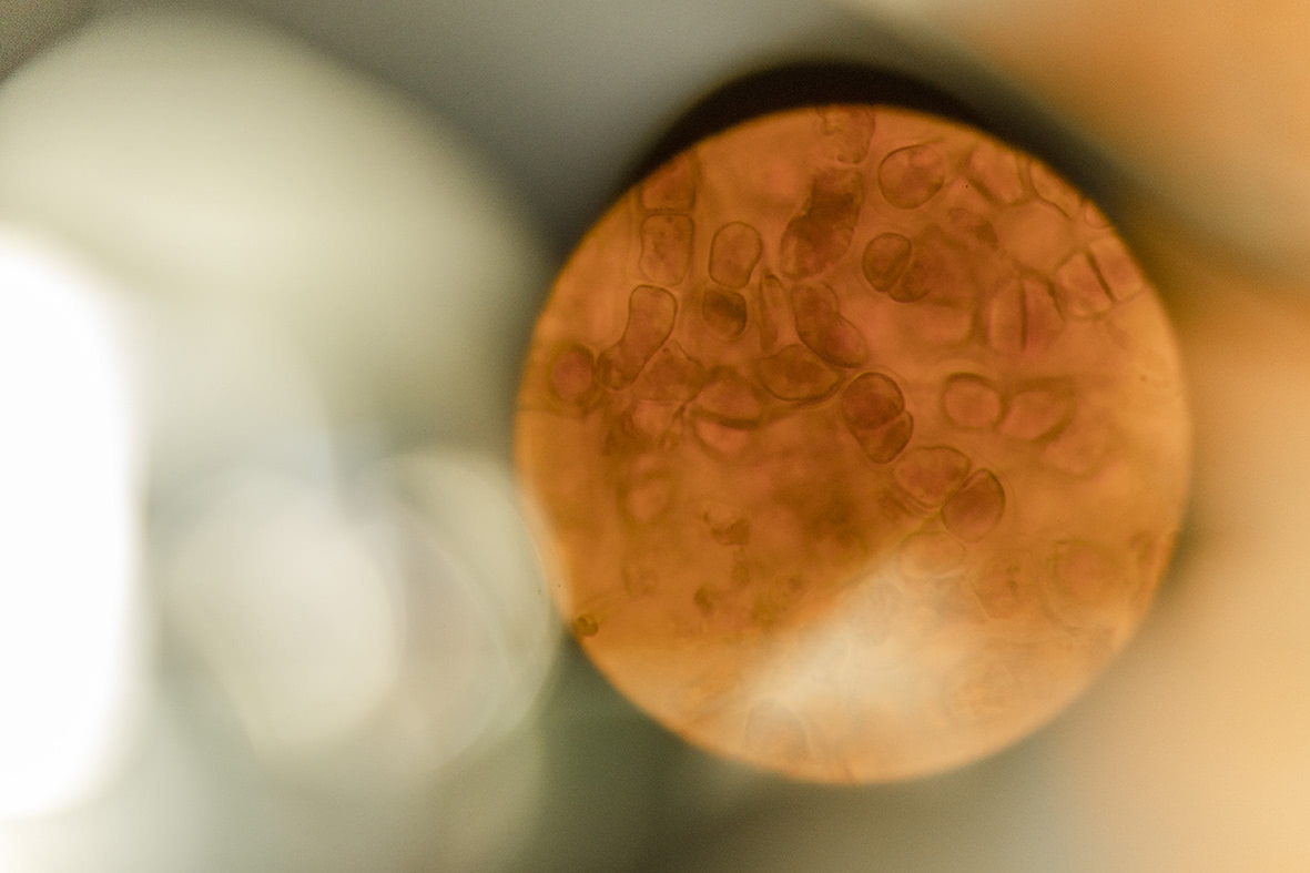 顕微鏡で見える海苔の種