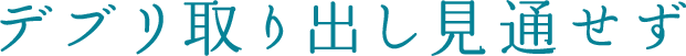 デブリ取り出し見通せず