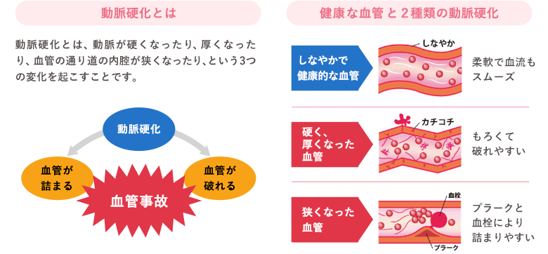 ゾンビ運動で 血管しなやか 神に生かされた人生